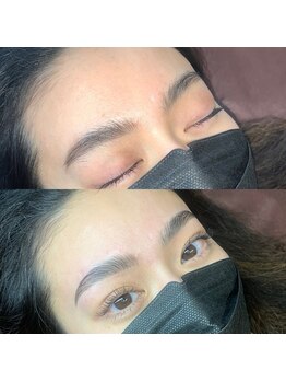 アンベリール(embellir)/ハリウッドブロウリフト(HBL)