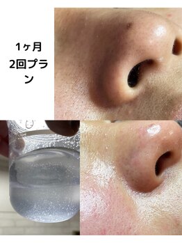 ウィステリア(WISTERIA)/ぼつぼつ毛穴黒ずみ