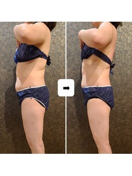 ワンルーム(1ROOM)/