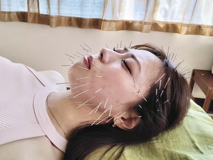 はりきゅう院 カワモトの写真