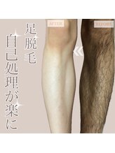 髭ラボ(髭LABO)/足脱毛☆自己処理が楽に