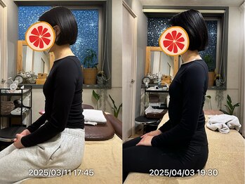 グレフル鍼灸接骨院 整体院 心斎橋/