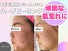 【リピーター様】REVIハーブピーリング+生酵素パウダー1g ¥ 17,400