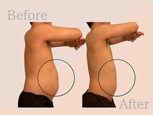 ファミーユ 名古屋店/【メンズ痩身ケア】お腹周り痩身