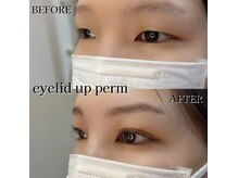 プリティアイ(pretty eye)/アイリッドアップパーマ
