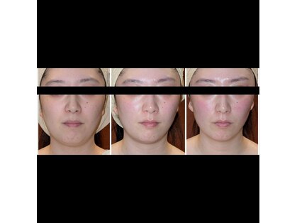 ナコズ エステティック(Nakos esthetic)の写真