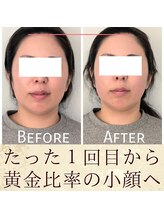 スウ(suu.)/Before-After【30代】1回