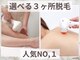フェイスアンドボディルーム サクラ(SAKURA)の写真/夏に向けて脱毛!お好きなパーツを選べる3箇所を都度払いでお試ししてみませんか☆