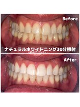 ライトビューティー 関内店(LIGHT BEAUTY)/[ ナチュラルホワイトニング ]