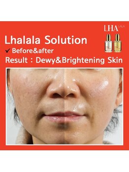 リエル(Liel)/ララピール☆キメを整え水光肌へ