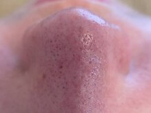 リセットプラス(Reset+)/