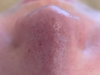 リセットプラス(Reset+)/