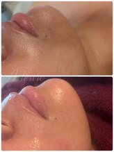 エルール トータルビューティ(Aileure total beauty)/ララピール×スーパーフードWax