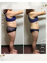 エスティ イオ(io)/ビフォーアフター