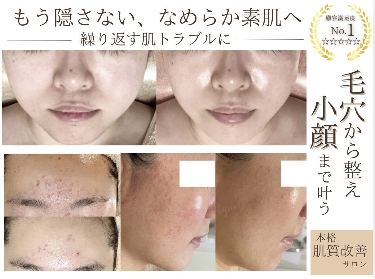 ソワンドビジュー(soin de bijew)｜ホットペッパービューティー