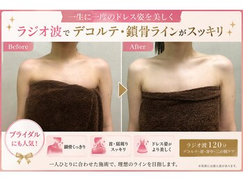 アロマリエ(al malie)の写真/一生に一度のドレス姿を美しく◆ブライダル専門ラジオ波ケア