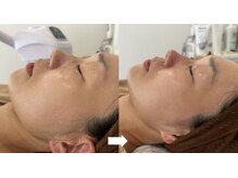 ミミ(mimi)の雰囲気（<肌質改善>お肌に合わせたケアで最短で肌質改善を目指します。）