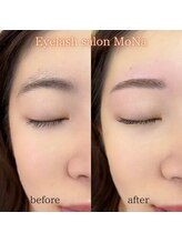 モナ(MoNa)/美眉WAX脱毛