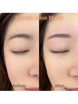 モナ(MoNa)/美眉WAX脱毛