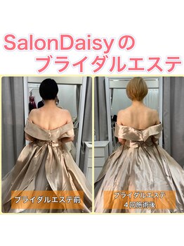サロンデイジー(Salon Daisy)/ブライダルエステ☆四回施術