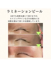 ヒュウ(hue.)/ラミネーションピール