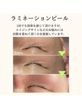 ヒュウ(hue.)/ラミネーションピール