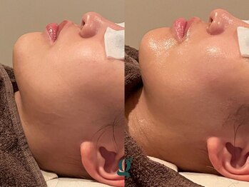 グレイスリリー 久屋 栄(grace lily)/