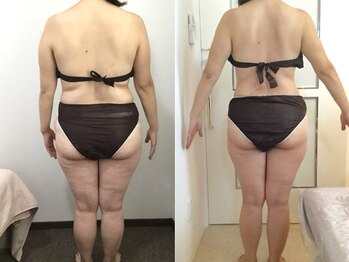 美容整体ウェリナ あま甚目寺院/.【ダイエットbefore→after】