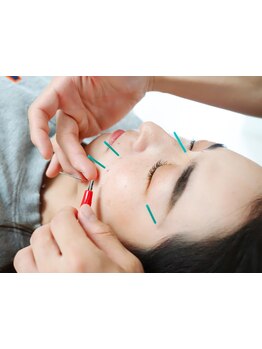 小顔になりたい