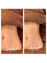 ボディーワークス 新町(BODY WORKS)/インディバでくびれ作り