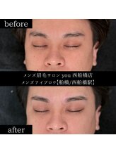 ユー 西船橋店(you)/ビフォーアフターお写真