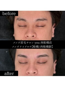 ユー 西船橋店(you)/ビフォーアフターお写真