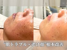 サロンノワ(salon noix)