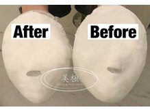 美極 トータルビューティー(美極 TOTAL BEAUTY)/恵比寿/小顔コルギ/エステ/