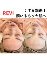 ギフト(gift)/ハーブピーリング/フェイシャル