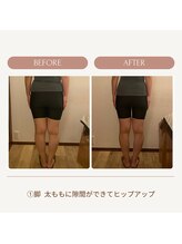 イロハナ(iro-hana)/ビフォーアフター