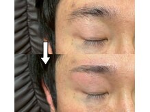 シュシュ(chou chou)/メンズアイブロウbefore・after