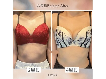 リオンズ(Rions)の写真