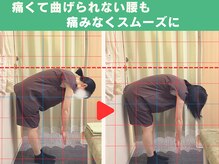 鍼灸 整体院 ひわたし/◇腰の痛みで曲げられない！