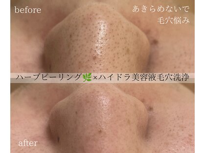 GRACETHOUSAND(グレイスサウザンド)の写真