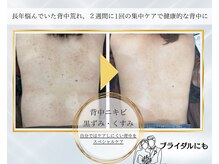 エレナ(ELENA)の雰囲気（【背中美人になれる】長年のお悩みや、ブライダルに）