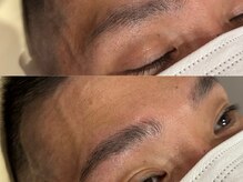 ビクシー(vixxcy)/