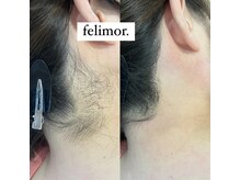 フェリモール(Felimor.)/シュガーリングbefore／after