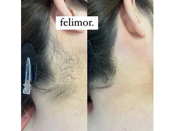 フェリモール(Felimor.)/シュガーリングbefore／after