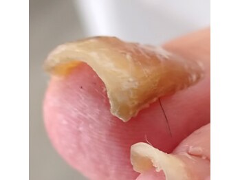 強い変形でもOK