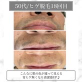 リバース 大曽根(Re.BIRTH)