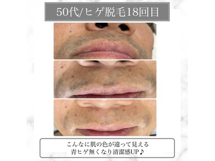 リバース 大曽根(Re.BIRTH)の写真