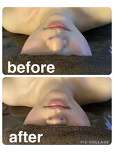 ギンザアール(GINZA R.)/すっきり小顔に♪