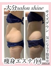 サロンシャイン(Salon Shine)/30代女性痩身エステ１回