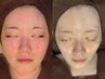 【肌磨きセット】顔脱毛＆毛穴ケア+透明感チャージ｜贅沢フェイシャルコース